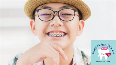 teens braces porn|14 Essential Tips and FAQ for Teens in Braces: Mastering Oral.